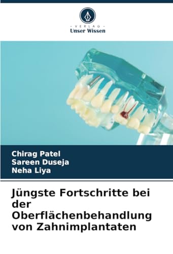 Jüngste Fortschritte bei der Oberflächenbehandlung von Zahnimplantaten von Verlag Unser Wissen