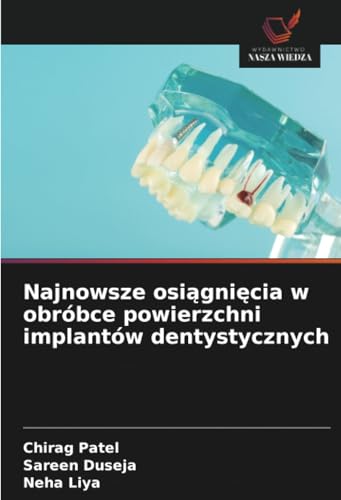 Najnowsze osiągnięcia w obróbce powierzchni implantów dentystycznych von Wydawnictwo Nasza Wiedza