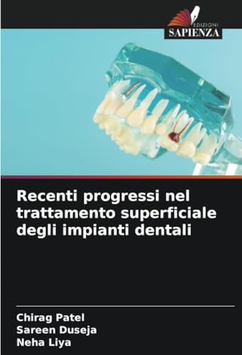Recenti progressi nel trattamento superficiale degli impianti dentali von Edizioni Sapienza