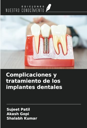 Complicaciones y tratamiento de los implantes dentales von Ediciones Nuestro Conocimiento