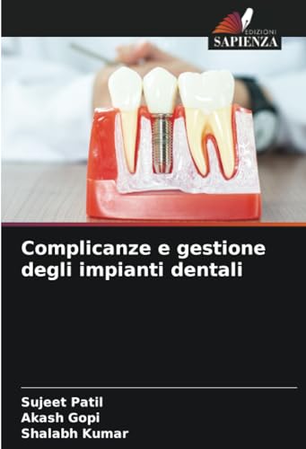 Complicanze e gestione degli impianti dentali von Edizioni Sapienza