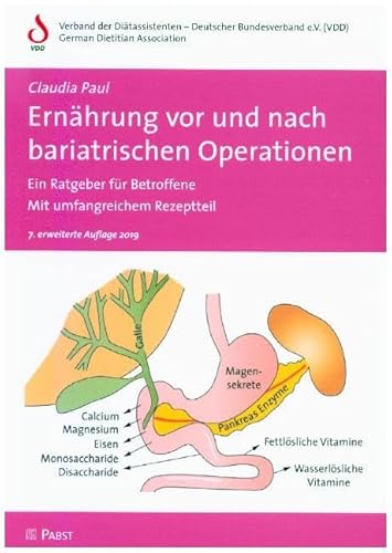 Ernährung vor und nach bariatrischen Operationen: Ein Ratgeber für Betroffene • Mit umfangreichem Rezeptteil