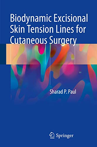 Biodynamic Excisional Skin Tension Lines for Cutaneous Surgery von Springer