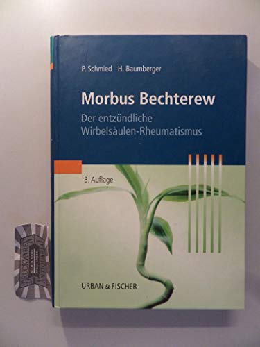 Morbus Bechterew: Der entzündliche Wirbelsäulen-Rheumatismus von Urban & Fischer/Elsevier