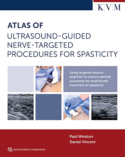 Atlas of Ultrasound-Guided Nerve-Targeted Procedures for Spasticity: Maximizing Outcomes for the Patient with Spasticity Through Optima Muscle Selection von KVM - Der Medizinverlag