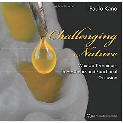 Challenging Nature: Wax-Up Techniques in Aesthetics and Functional Occlusion von Quintessence Publishing (IL)