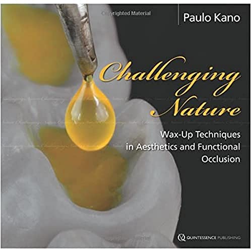 Challenging Nature: Wax-Up Techniques in Aesthetics and Functional Occlusion von Quintessence Publishing