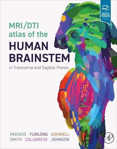 MRI/DTI Atlas of the Human Brainstem in Transverse and Sagittal Planes von Academic Press