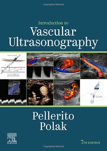 Introduction to Vascular Ultrasonography: Expert Consult - Online and Print von Elsevier