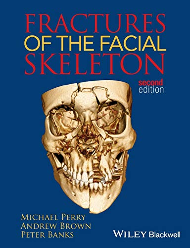 Fractures of the Facial Skeleton, 2nd Edition
