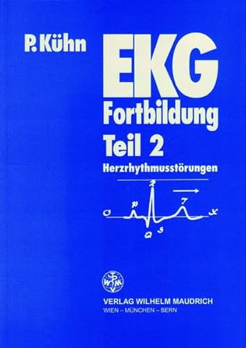 EKG-Fortbildung 2. Herzrhythmusstörungen