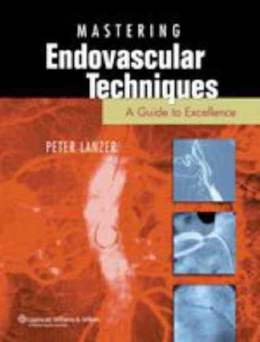Mastery of Endovascular Interventions: A Guide to Excellence von Lippincott Williams&Wilki