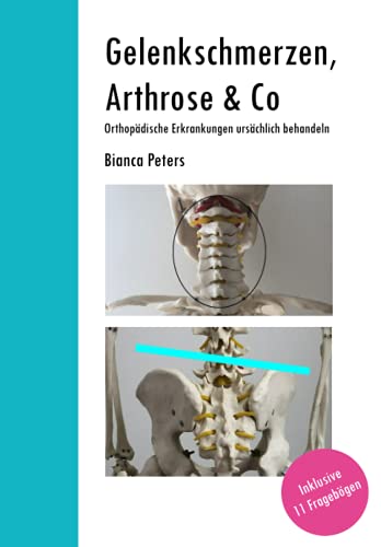 Gelenkschmerzen, Arthrose & Co: Orthopädische Erkrankungen ursächlich behandeln von Independently published