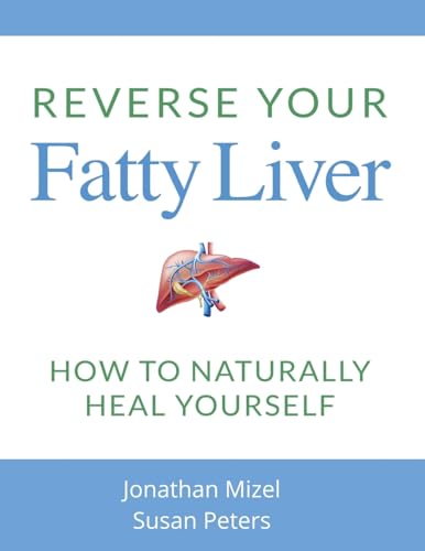 Reverse Your Fatty Liver: How To Naturally Heal Yourself von CreateSpace Independent Publishing Platform
