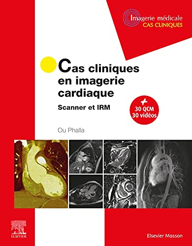 Cas cliniques en imagerie cardiaque: Scanner et IRM von MASSON