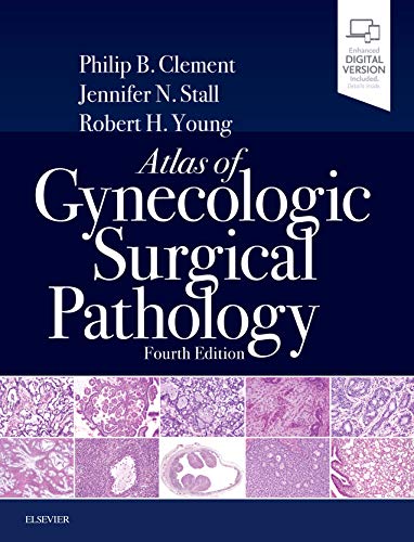 Atlas of Gynecologic Surgical Pathology: Expert Consult: Online and Print von Elsevier