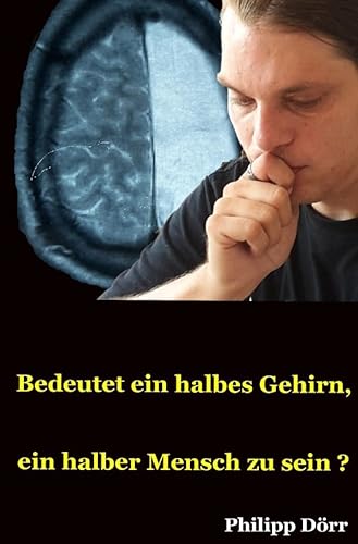 Bedeutet ein halbes Gehirn, ein halber Mensch zu sein?