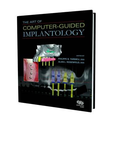 The Art of Computer-Guided Implantology von Brand: Quintessence Pub Co