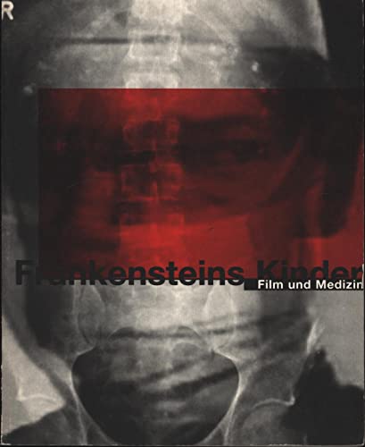 Frankensteins Kinder, Film Und Medizin