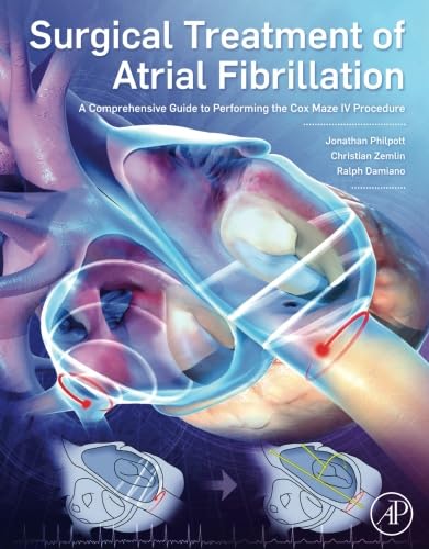 Surgical Treatment of Atrial Fibrillation: A Comprehensive Guide to Performing the Cox Maze IV Procedure von Academic Press