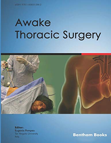 Awake Thoracic Surgery Awake Thoracic Surgery von Bentham Science Publishers