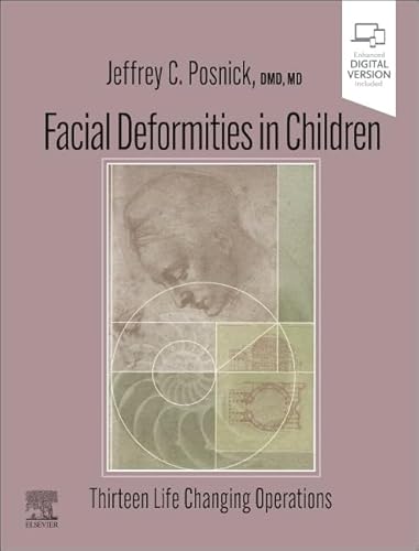 Facial Deformities in Children: Thirteen Life Changing Operations von Elsevier