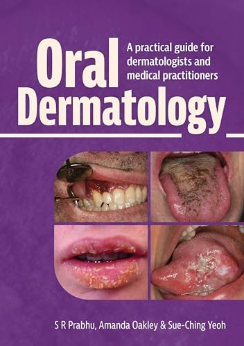 Oral Dermatology: A practical guide for dermatologists and medical practitioners (General Practice)
