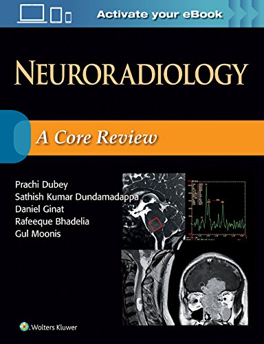 Neuroradiology: A Core Review von LWW