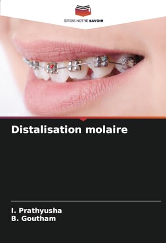 Distalisation molaire: DE von Editions Notre Savoir