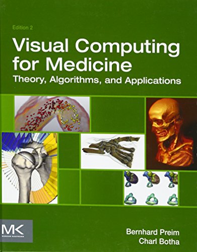 Visual Computing for Medicine: Theory, Algorithms, and Applications (The Morgan Kaufmann Series in Computer Graphics)