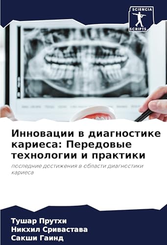 Innowacii w diagnostike kariesa: Peredowye tehnologii i praktiki: poslednie dostizheniq w oblasti diagnostiki kariesa von Sciencia Scripts