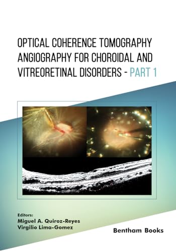 Optical Coherence Tomography Angiography for Choroidal and Vitreoretinal Disorders - Part 1 von Bentham Science Publishers