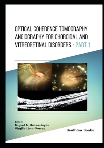 Optical Coherence Tomography Angiography for Choroidal and Vitreoretinal Disorders - Part 1 von Bentham Science Publishers