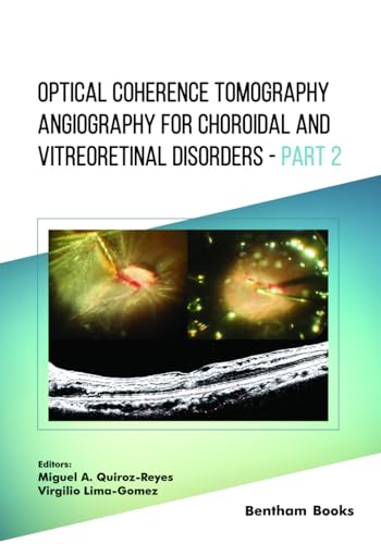 Optical Coherence Tomography Angiography for Choroidal and Vitreoretinal Disorders – Part 2 von Bentham Science Publishers