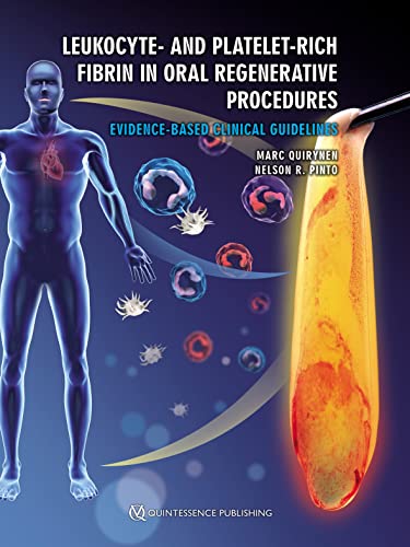 Leukocyte- and Platelet-Rich Fibrin in Oral Regenerative Procedures: Evidence-Based Clinical Guidelines Leukocyte- and Platelet-Rich Fibrin in Oral Regenerative Procedures: Evidence-Based Clinical Guidelines von Quintessence Publishing