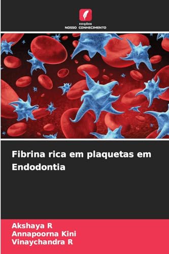 Fibrina rica em plaquetas em Endodontia: DE von Edições Nosso Conhecimento