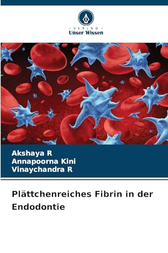 Plättchenreiches Fibrin in der Endodontie von Verlag Unser Wissen