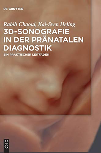 3D-Sonografie in der pränatalen Diagnostik: Ein praktischer Leitfaden