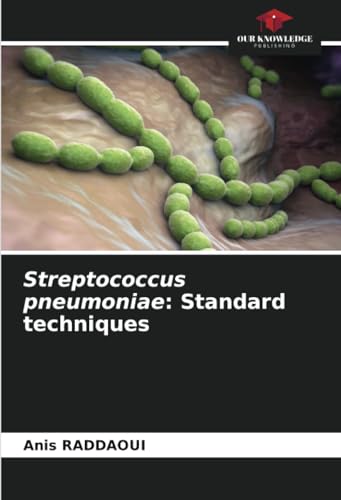 Streptococcus pneumoniae: Standard techniques: DE von Our Knowledge Publishing