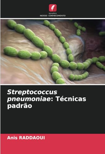 Streptococcus pneumoniae: Técnicas padrão: DE von Edições Nosso Conhecimento