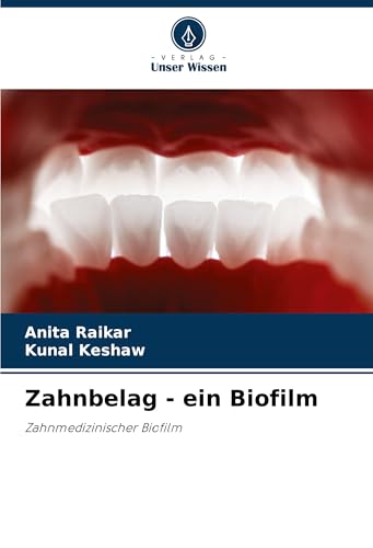 Zahnbelag - ein Biofilm: Zahnmedizinischer Biofilm von Verlag Unser Wissen