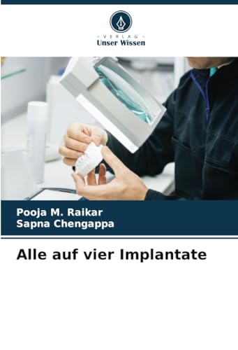 Alle auf vier Implantate: DE von Verlag Unser Wissen