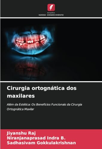 Cirurgia ortognática dos maxilares: Além da Estética: Os Benefícios Funcionais da Cirurgia Ortognática Maxilar von Edições Nosso Conhecimento
