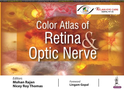 Color Atlas of Retina and Optic Nerve