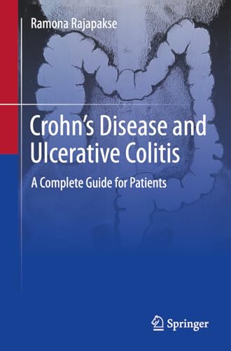 Crohn's Disease and Ulcerative Colitis: A Complete Guide for Patients von Springer
