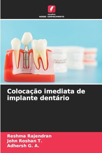 Colocação imediata de implante dentário von Edições Nosso Conhecimento