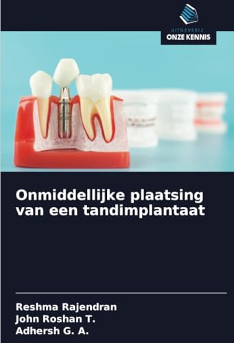Onmiddellijke plaatsing van een tandimplantaat von Uitgeverij Onze Kennis