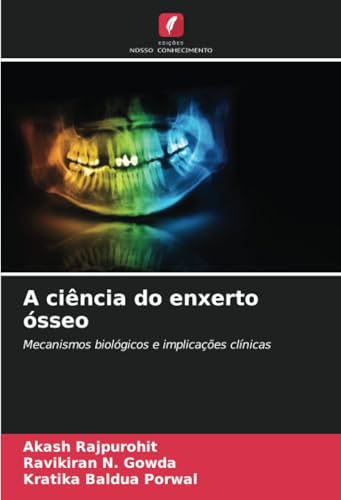 A ciência do enxerto ósseo: Mecanismos biológicos e implicações clínicas von Edições Nosso Conhecimento