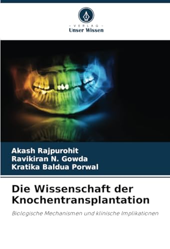 Die Wissenschaft der Knochentransplantation: Biologische Mechanismen und klinische Implikationen von Verlag Unser Wissen