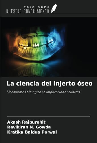 La ciencia del injerto óseo: Mecanismos biológicos e implicaciones clínicas von Ediciones Nuestro Conocimiento